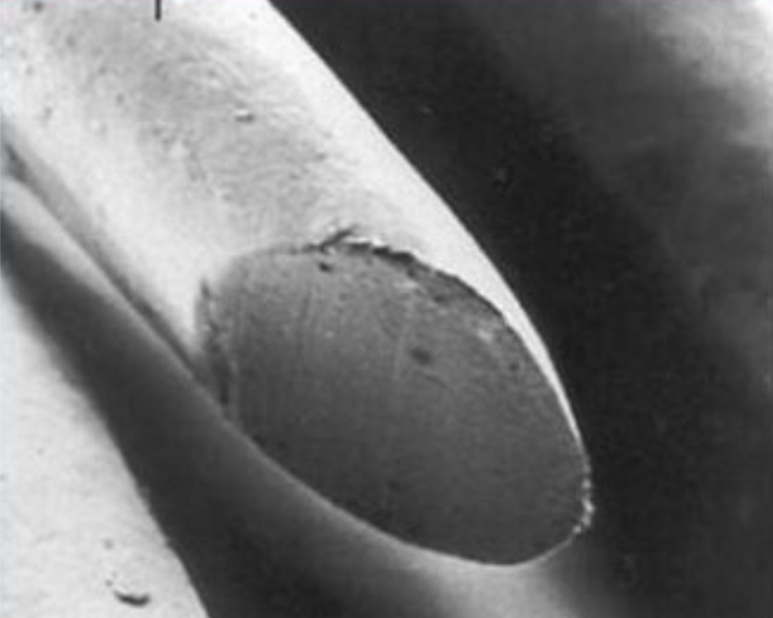 Vorher Nachher heiße Schere – weniger Spliss, ruhiger Haarfall